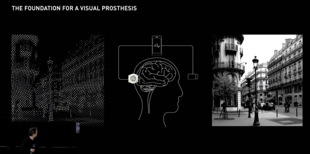 今年 Neuralink 的大腦裝置多了一個功能，就是可以恢復失明人士視力。